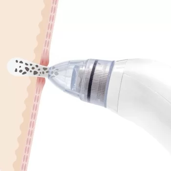 Electric Blackhead Facial Cleanser Pore·Off InnovaGoods 2